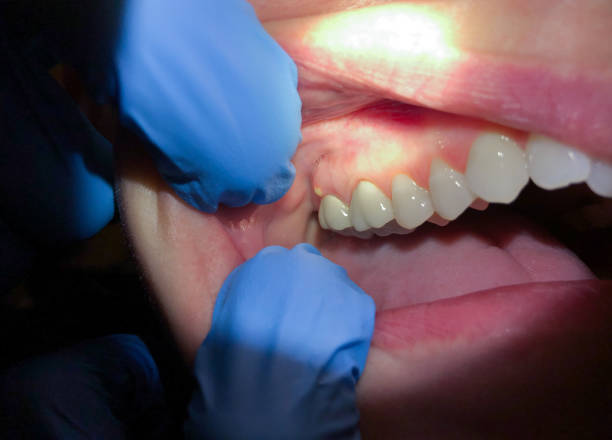 Dentist for Dental Trauma in IN